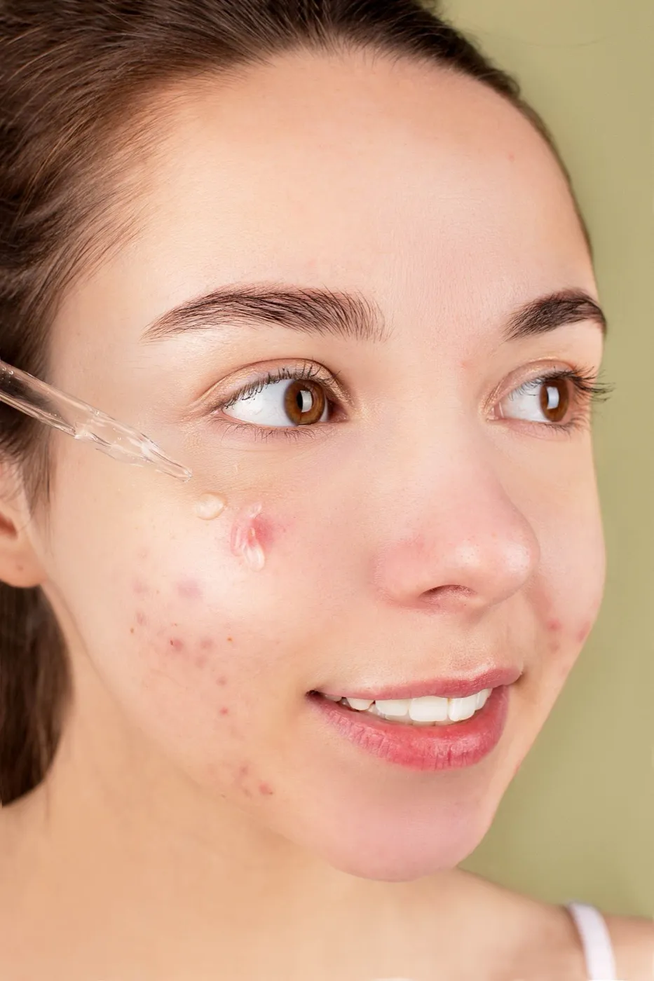 Een vrouw met onzuiverheden op haar wang brengt serum aan