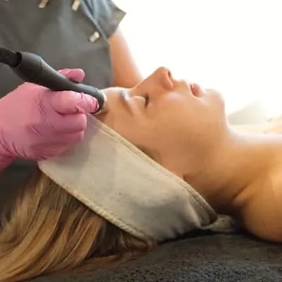 Microdermabrasie op de wang